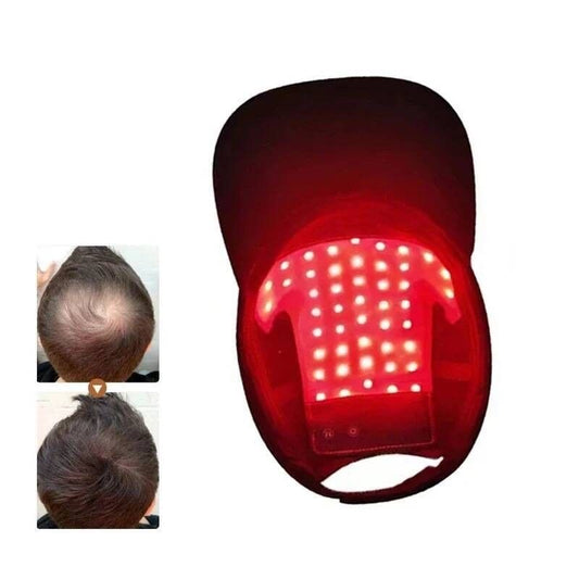 HairBoost™ Red Light Therapy Cap