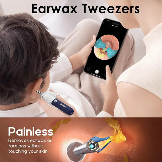 Bebird Earsight Plus Wireless Ear Wax Removal Camera - HD, Rechargeable