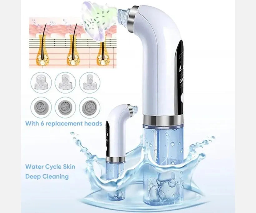 Vacuum Pore Cleaner – 6-in-1 Blackhead Remover