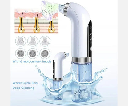 Vacuum Pore Cleaner – 6-in-1 Blackhead Remover