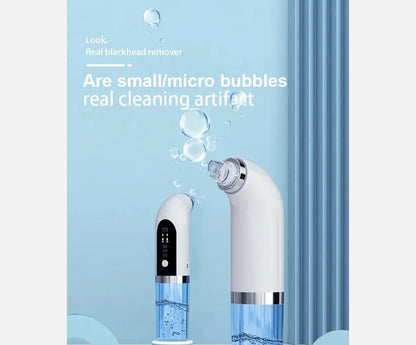 Vacuum Pore Cleaner – 6-in-1 Blackhead Remover