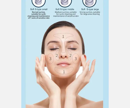 Vacuum Pore Cleaner – 6-in-1 Blackhead Remover