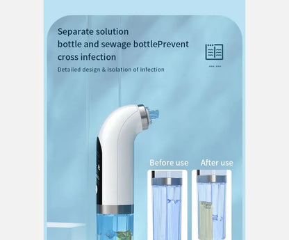 Vacuum Pore Cleaner – 6-in-1 Blackhead Remover