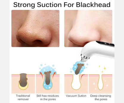 Vacuum Pore Cleaner – 6-in-1 Blackhead Remover