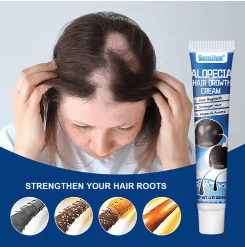 Sumifun Original Hair Growth Cream - Hair Loss Treatment for Thicker, Stronger Hair